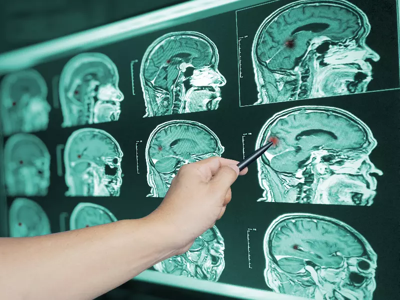 Concussion Treatment Near Me in Fargo, ND. Chiropractic Consultation for Concussion Symptom Relief.